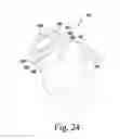 Fig. 11 - Stemless humeral component of an orthopaedic shoulder prosthesis