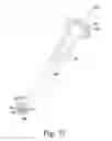 Fig. 19 - Stemless humeral component of an orthopaedic shoulder prosthesis