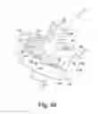 Fig. 26 - Stemless humeral component of an orthopaedic shoulder prosthesis