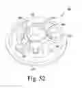 Fig. 28 - Stemless humeral component of an orthopaedic shoulder prosthesis
