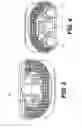 Fig. 04 - Intervertebral Implants and Related Methods of Use