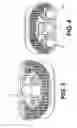 Fig. 04 - Intervertebral Implants and Related Methods of Use