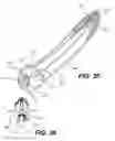 Fig. 17 - Intervertebral Implants and Related Methods of Use