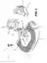 Fig. 03 - Intervertebral implants and related methods of use