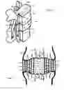Fig. 02 - Method for relieving pain and regenerating intervertebral disc
