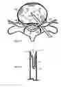 Fig. 09 - Method for relieving pain and regenerating intervertebral disc