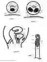 Fig. 22 - Method for relieving pain and regenerating intervertebral disc