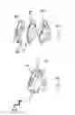 Fig. 03 - Anterior prosthetic spinal disc replacement