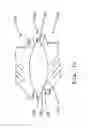 Fig. 13 - Anterior prosthetic spinal disc replacement
