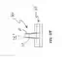 Fig. 20 - Anterior prosthetic spinal disc replacement