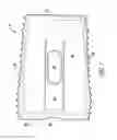 Fig. 04 - Bioactive spinal implants and method of manufacture thereof