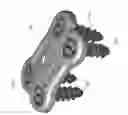 Fig. 09 - Bioactive spinal implants and method of manufacture thereof