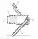 Fig. 22 - Bioactive spinal implants and method of manufacture thereof