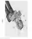 Fig. 30 - Bioactive spinal implants and method of manufacture thereof