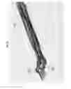 Fig. 33 - Bioactive spinal implants and method of manufacture thereof