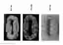 Fig. 55 - Bioactive spinal implants and method of manufacture thereof