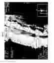 Fig. 56 - Bioactive spinal implants and method of manufacture thereof