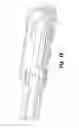 Fig. 22 - Expandable interbody fusion device