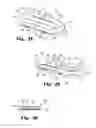 Fig. 33 - Expandable interbody fusion device