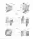 Fig. 09 - Expandable intervertebral implant