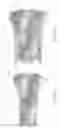 Fig. 16 - Expandable intervertebral implant