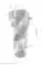 Fig. 17 - Expandable intervertebral implant