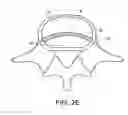 Fig. 07 - In-situ formed intervertebral fusion device and method