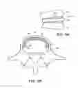 Fig. 15 - In-situ formed intervertebral fusion device and method