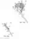Fig. 29 - In-situ formed intervertebral fusion device and method