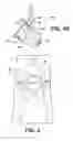 Fig. 05 - Instrument for use in minimally invasive surgery