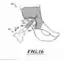Fig. 15 - DEVICES AND METHODS FOR HIP REPLACEMENT