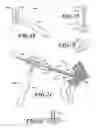 Fig. 17 - DEVICES AND METHODS FOR HIP REPLACEMENT