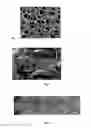 Fig. 02 - Device to be implanted in human or animal tissue and method for implanting and assembling the device
