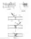 Fig. 13 - Device to be implanted in human or animal tissue and method for implanting and assembling the device