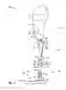 Fig. 04 - Limb prosthesis system and method