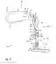 Fig. 08 - Limb prosthesis system and method
