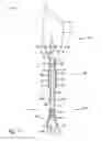 Fig. 11 - Limb prosthesis system and method