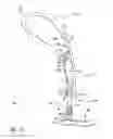Fig. 13 - Limb prosthesis system and method