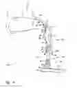 Fig. 14 - Limb prosthesis system and method