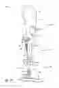 Fig. 22 - Limb prosthesis system and method