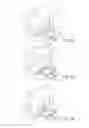 Fig. 07 - PROSTHETIC SOCKET WITH AN ADJUSTABLE HEIGHT ISCHIAL SEAT