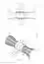 Fig. 03 - MEDICAL DEVICES INCLUDING COVERS AND METHODS FOR MAKING AND USING SAME
