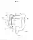 Fig. 15 - Gastrointestinal device with associated commensal microbes
