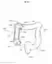 Fig. 15 - Gastrointestinal device with associated commensal microbes