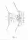 Fig. 11 - Joint orthosis