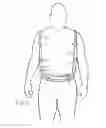 Fig. 02 - Back supporter