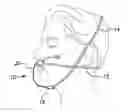 Fig. 01 - Sleep apnea prevention