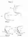 Fig. 03 - Sleep apnea prevention
