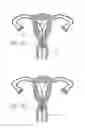 Fig. 08 - INTRAUTERINE DEVICE