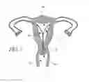 Fig. 10 - INTRAUTERINE DEVICE